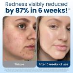 Biobased Face Towel, Disposable Face Towelette, Eczema Association Accepted, Makeup Remover Dry Wipes, Ultra Soft, 1 Pack,